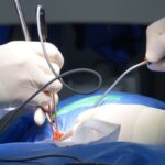 medical malpractice damages