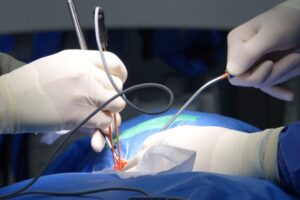 Medical Malpractice Damages: What Compensation Can Include