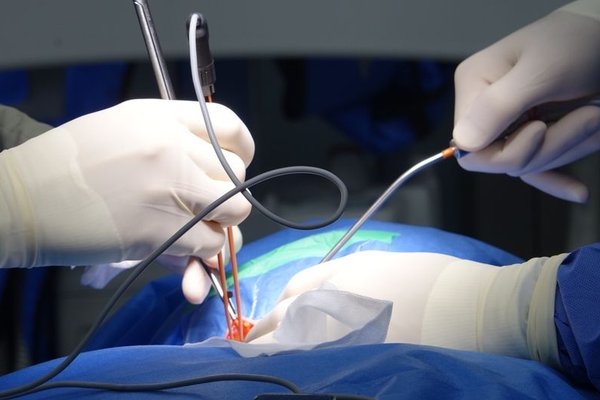 medical malpractice damages